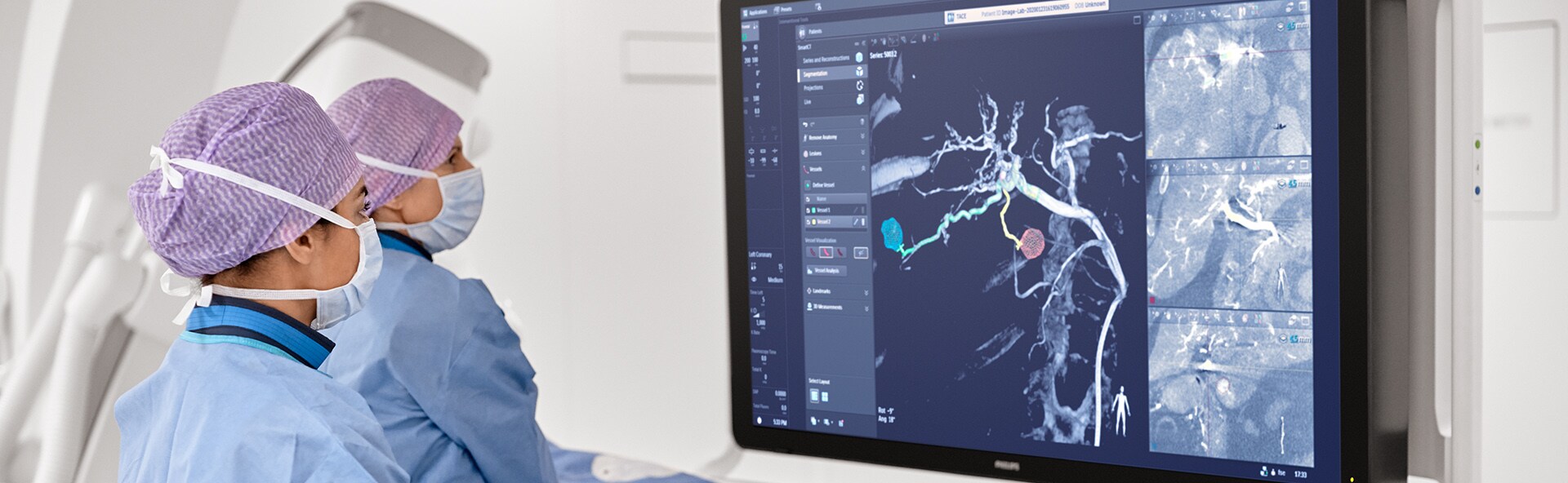 IGT Terapia Guiada Por Imagen - Sala de Radiología Intervencionista y Oncología