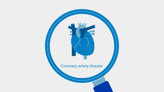 Soluciones integradas en el proceso asistencial de coronariopatías