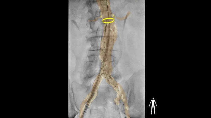 Contacto de la suite Vascular