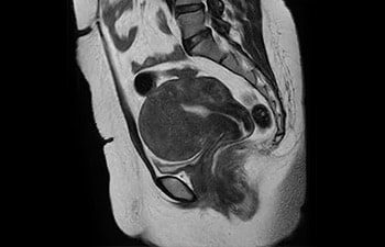 Pelvis image