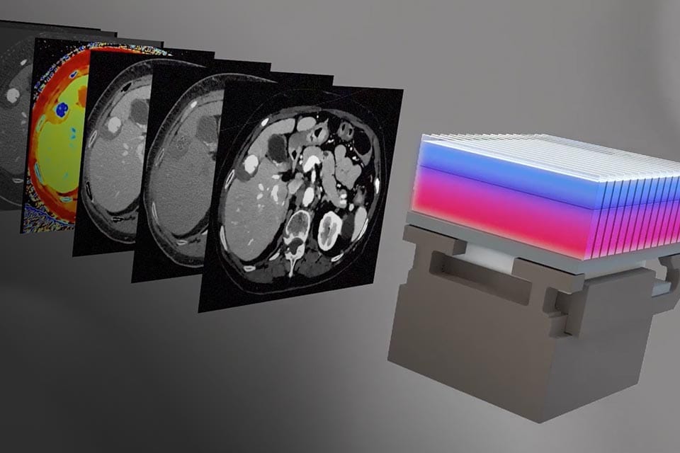 The Philips Spectral CT 7500 features a 80cm bore
