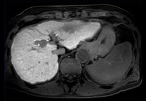 SmartSpeed 3D FreeBreathing de Philips