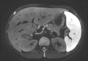 Difusi&oacute;n SmartSpeed de Philips