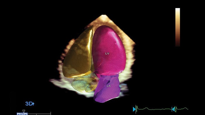 Inteligencia anatómica para ultrasonidos