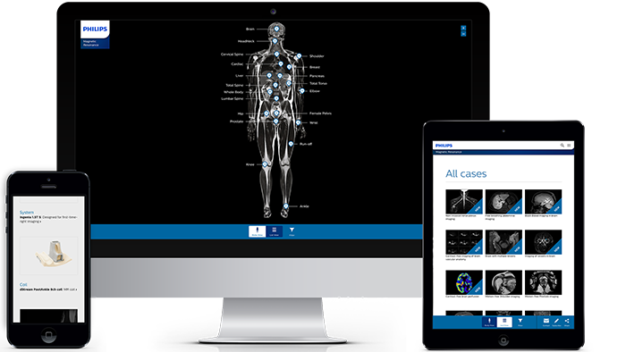 Mapa del cuerpo con el RM