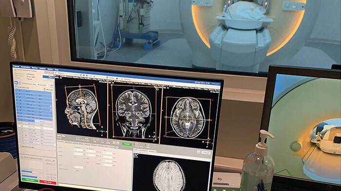 Hospital Clínico San Borja Arriarán adquiere resonador magnético con tecnología Philips de última generación