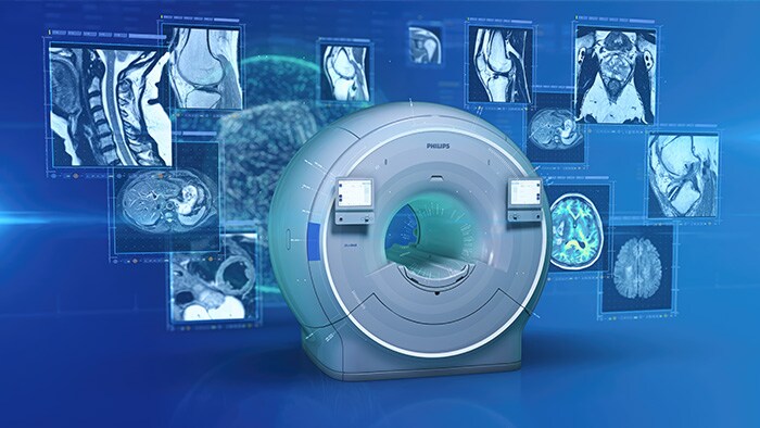 Philips HealthTech Spot: Episodio 4 – Calidad de imagen y velocidad a su alcance con Philips SmartSpeed