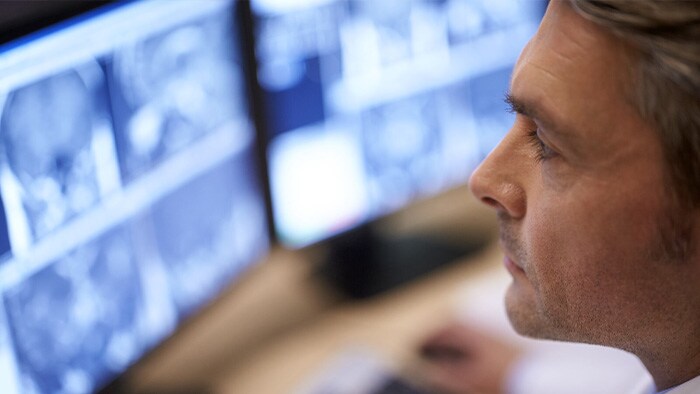 Philips HealthTech Spot: Episodio 7 – Conozca los últimos avances en diagnóstico por imágenes