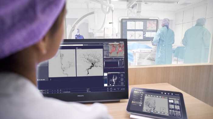 Philips presentó novedosos avances en Neurointervención en el 3er Congreso Chileno de Enfermedades Cerebrovasculares.